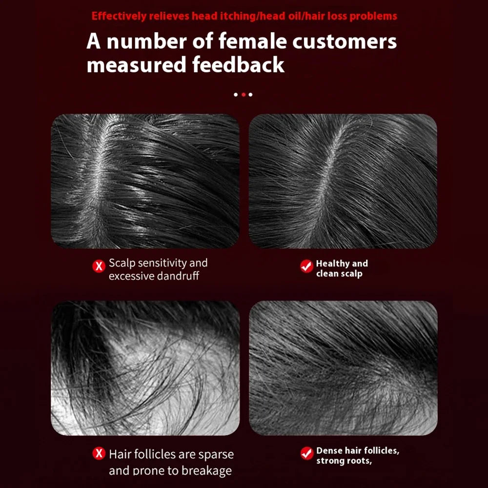 ModoHome™ Red Light Scalp Massager – 3-Mode Hair Growth & Relaxation Comb